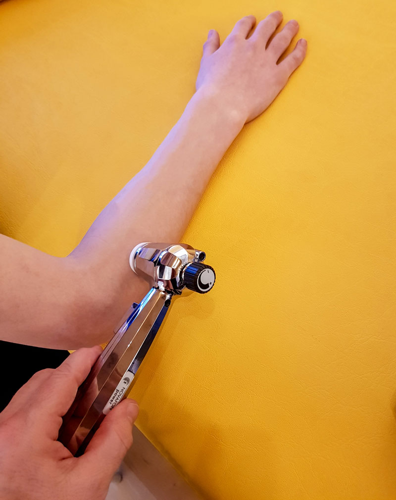 Schallwellenteaser am Unterarm